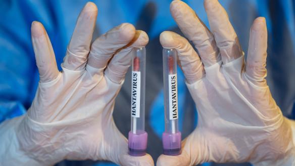 Tubos de muestras de hantavirus.