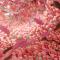 Intestino, en una imagen de archivo.