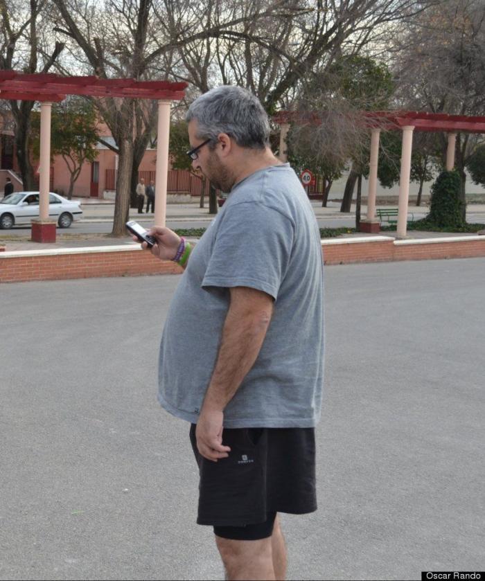 Vende su grasa corporal para salvar a ONG