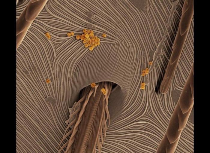 Imágenes con microscopio: café, arañas y pan convertidos en espectáculos visuales (FOTOS)