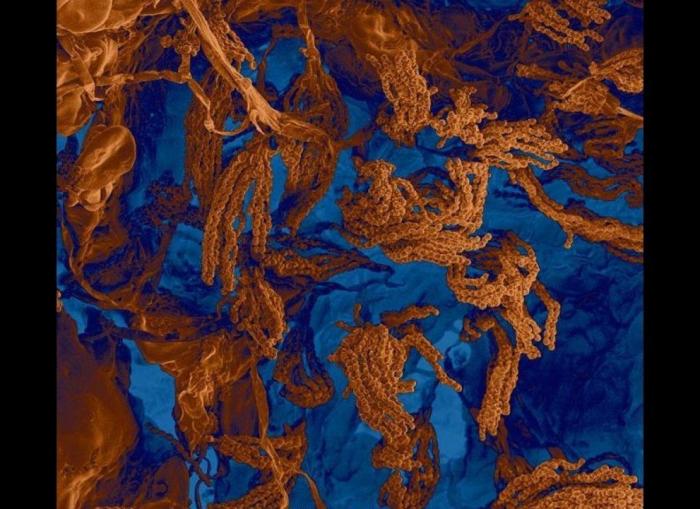 Imágenes con microscopio: café, arañas y pan convertidos en espectáculos visuales (FOTOS)