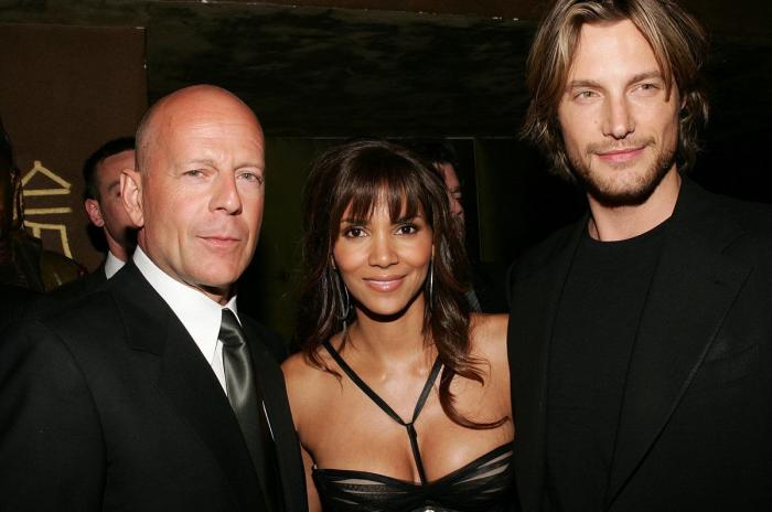 Pelea en casa de Halle Berry: así quedó Gabriel Aubry tras acabar a golpes con Olivier Martínez (FOTOS)