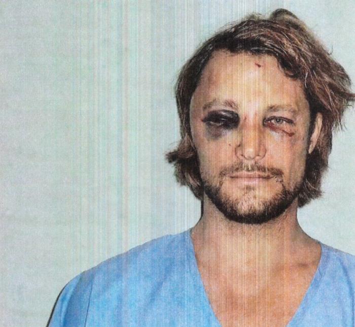 Pelea en casa de Halle Berry: así quedó Gabriel Aubry tras acabar a golpes con Olivier Martínez (FOTOS)