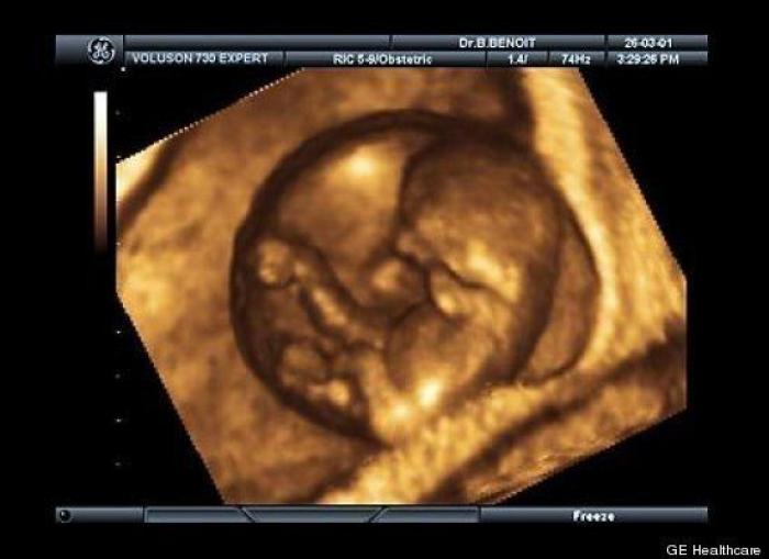 Vídeo del primer año de un bebé prematuro