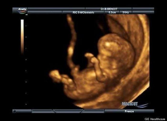 Vídeo del primer año de un bebé prematuro