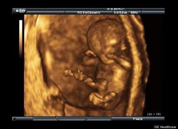 Vídeo del primer año de un bebé prematuro