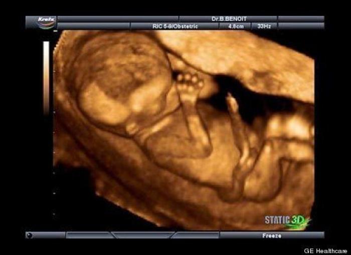 Vídeo del primer año de un bebé prematuro