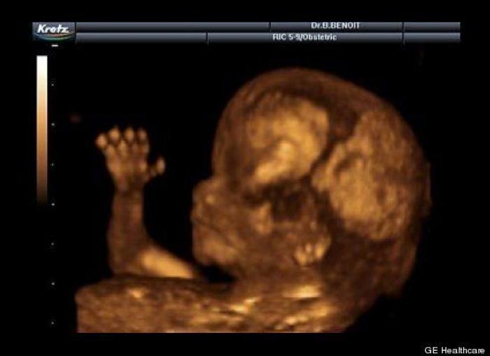 Vídeo del primer año de un bebé prematuro