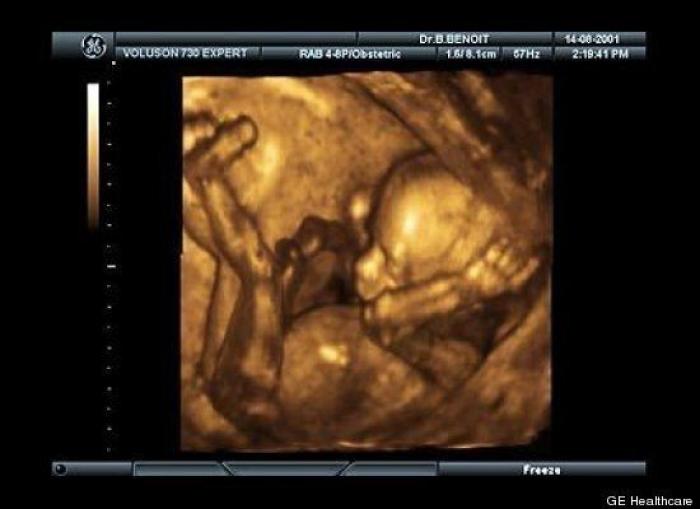 Vídeo del primer año de un bebé prematuro