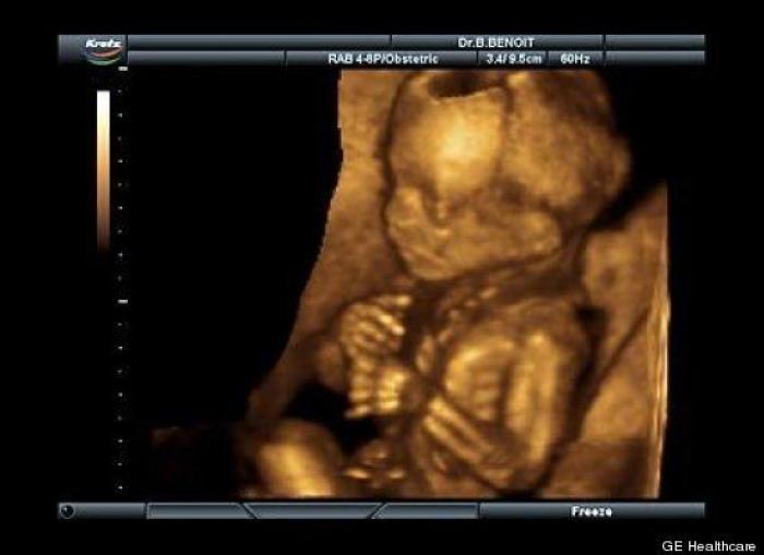 Vídeo del primer año de un bebé prematuro