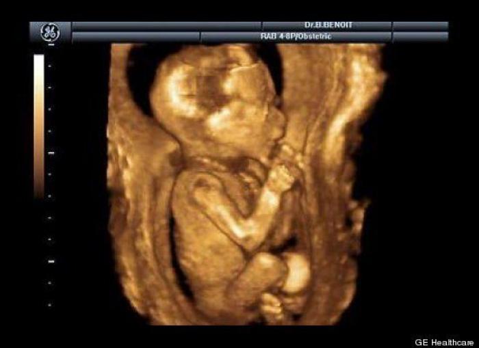 Vídeo del primer año de un bebé prematuro