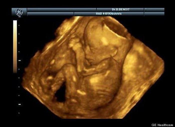 Vídeo del primer año de un bebé prematuro