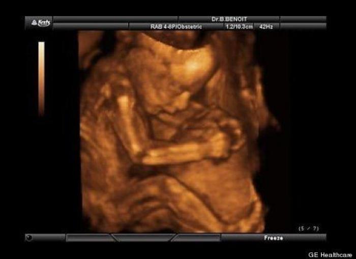 Vídeo del primer año de un bebé prematuro