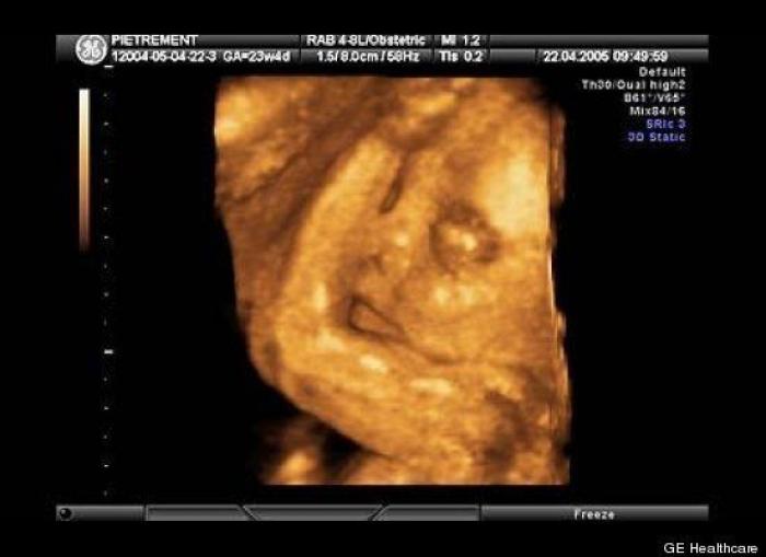 Vídeo del primer año de un bebé prematuro