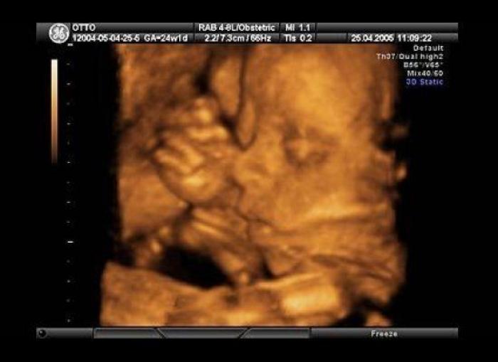 Vídeo del primer año de un bebé prematuro