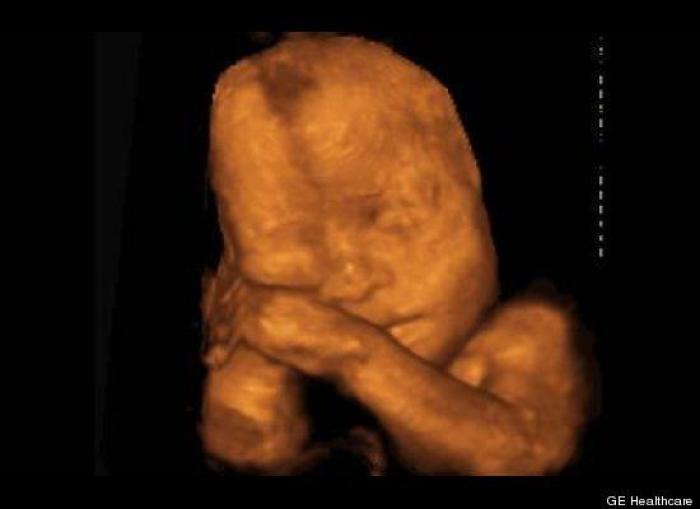 Vídeo del primer año de un bebé prematuro