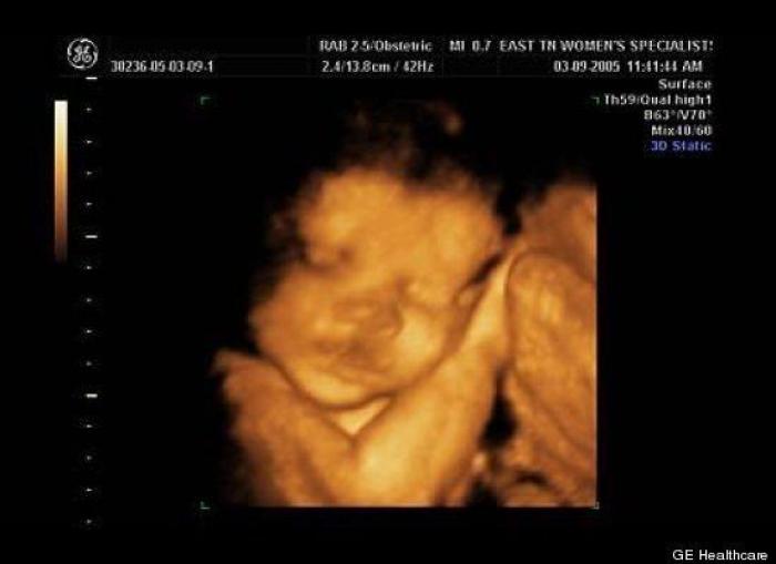 Vídeo del primer año de un bebé prematuro