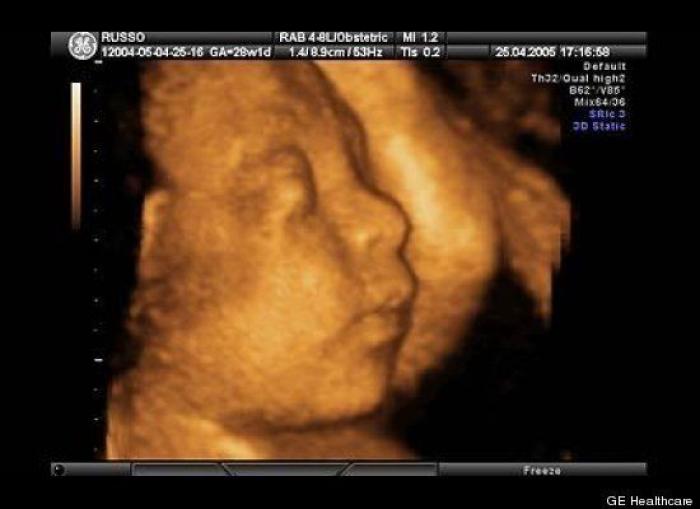 Vídeo del primer año de un bebé prematuro