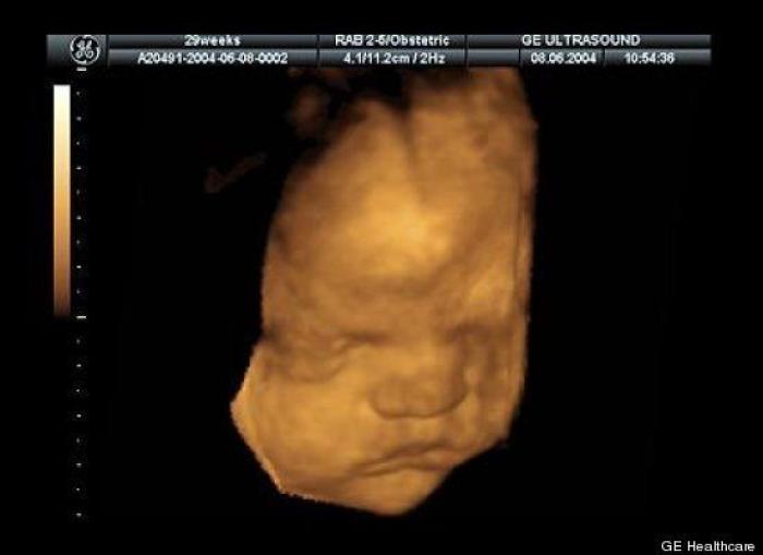 Vídeo del primer año de un bebé prematuro