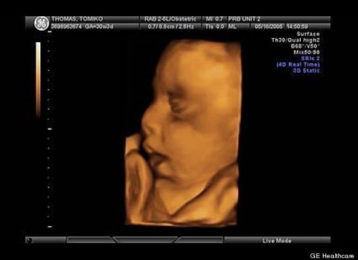 Vídeo del primer año de un bebé prematuro