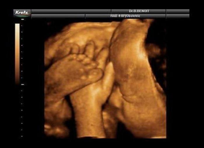 Vídeo del primer año de un bebé prematuro