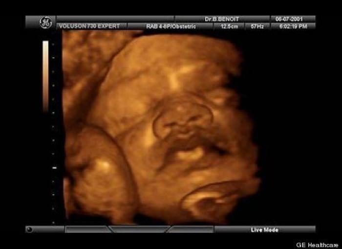 Vídeo del primer año de un bebé prematuro