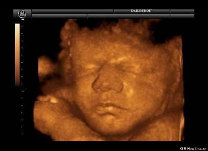 Vídeo del primer año de un bebé prematuro