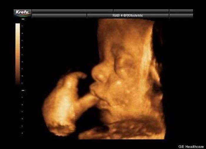 Vídeo del primer año de un bebé prematuro