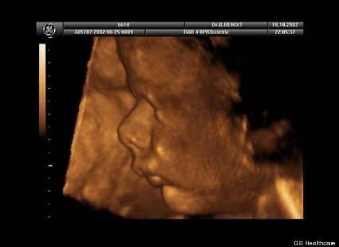 Vídeo del primer año de un bebé prematuro