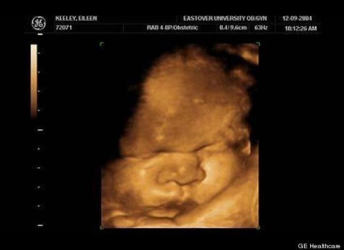 Vídeo del primer año de un bebé prematuro