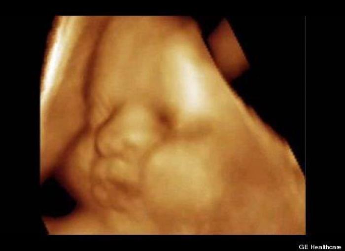 Vídeo del primer año de un bebé prematuro