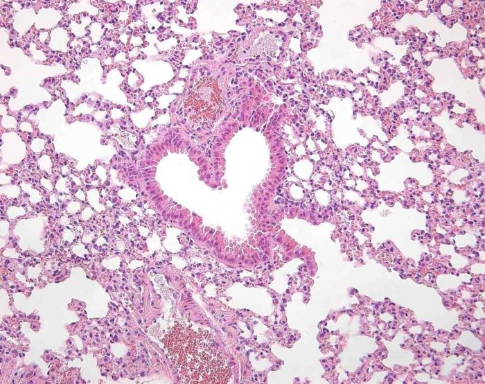 Fotografías de ciencia: la imágenes de la investigación del Cáncer del CNIO (FOTOS)