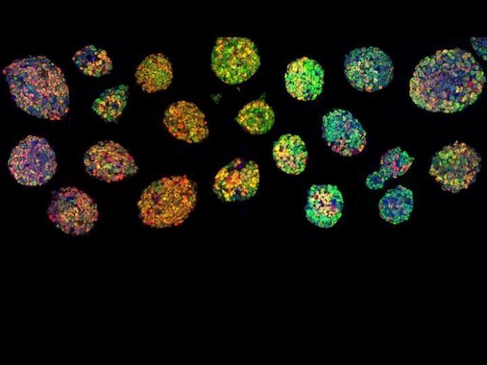 Fotografías de ciencia: la imágenes de la investigación del Cáncer del CNIO (FOTOS)