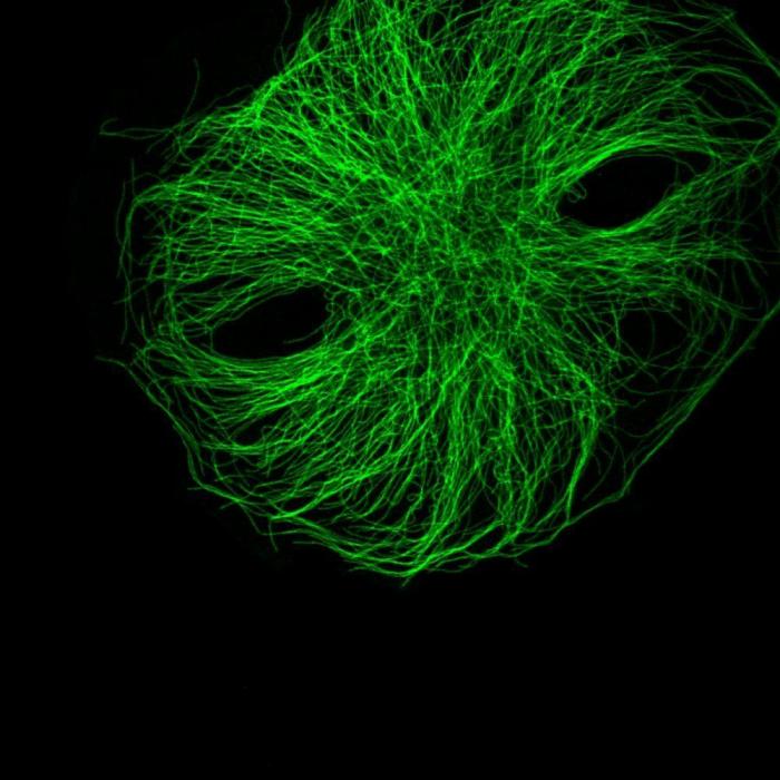 Fotografías de ciencia: la imágenes de la investigación del Cáncer del CNIO (FOTOS)