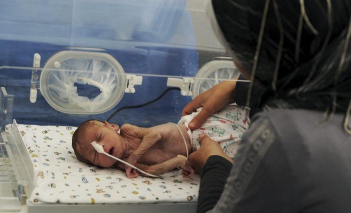 Listas de espera en la “atención temprana”: un sinsentido