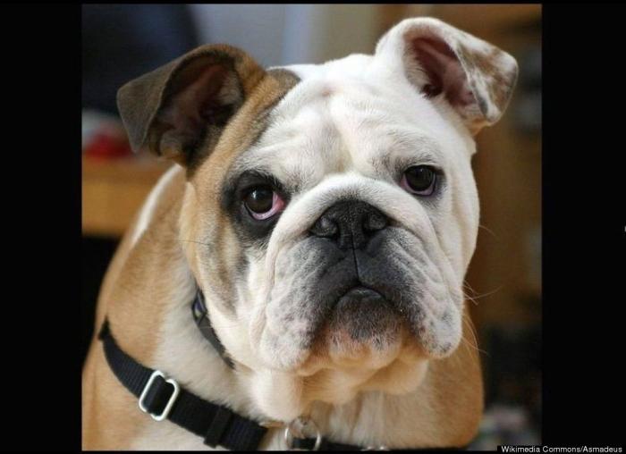 Una joven británica muere al confundirle un tumor con migrañas tras 14 visitas al médico