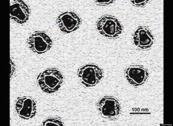 Una joven británica muere al confundirle un tumor con migrañas tras 14 visitas al médico
