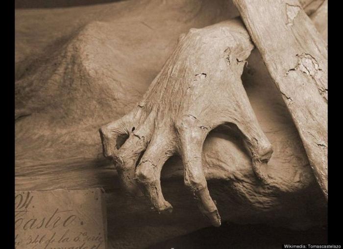 Una joven británica muere al confundirle un tumor con migrañas tras 14 visitas al médico