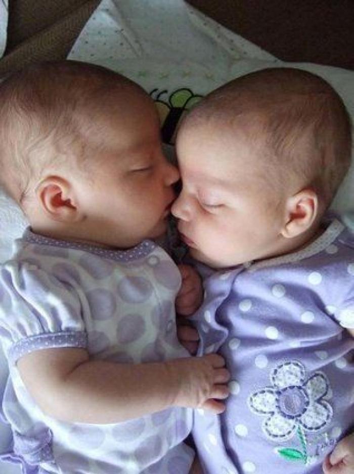 El divertido vídeo de una ecografía que muestra la pelea de dos gemelas