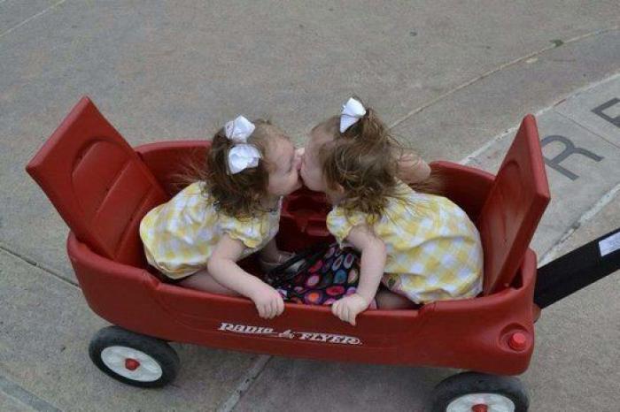 El divertido vídeo de una ecografía que muestra la pelea de dos gemelas