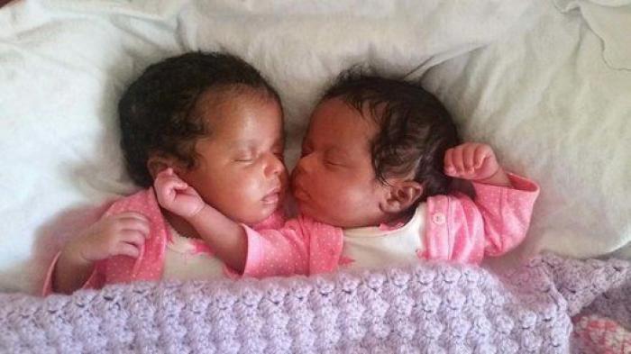 El divertido vídeo de una ecografía que muestra la pelea de dos gemelas