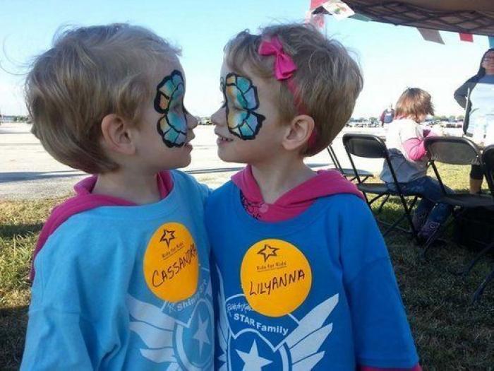 El divertido vídeo de una ecografía que muestra la pelea de dos gemelas