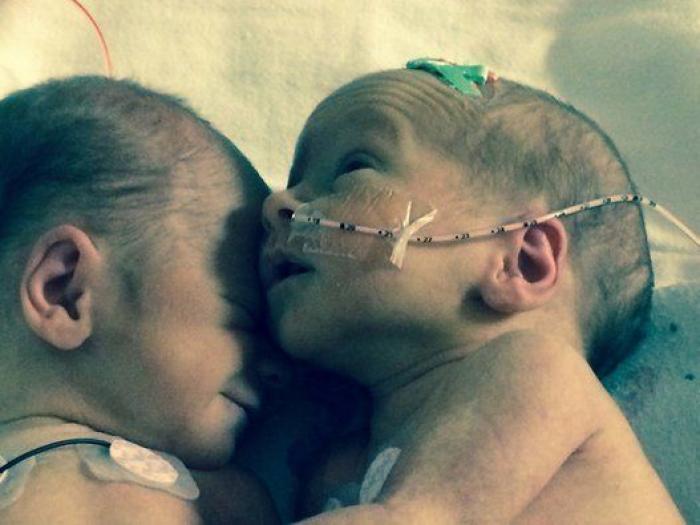 El divertido vídeo de una ecografía que muestra la pelea de dos gemelas