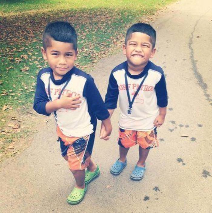 El divertido vídeo de una ecografía que muestra la pelea de dos gemelas