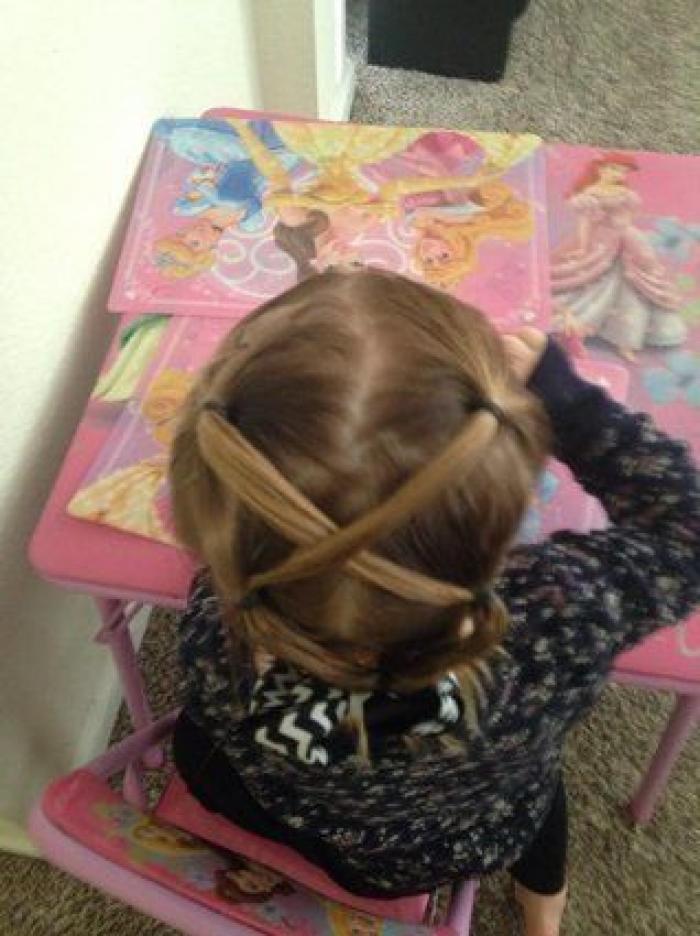 ¿Qué es lo que pasa cuando 'nos duele el pelo'?