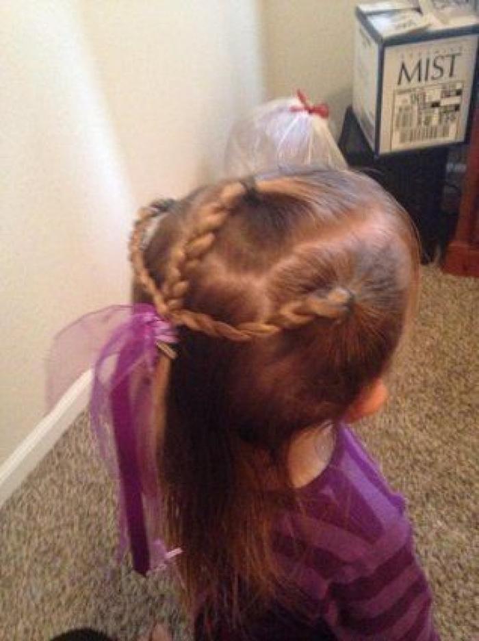 ¿Qué es lo que pasa cuando 'nos duele el pelo'?