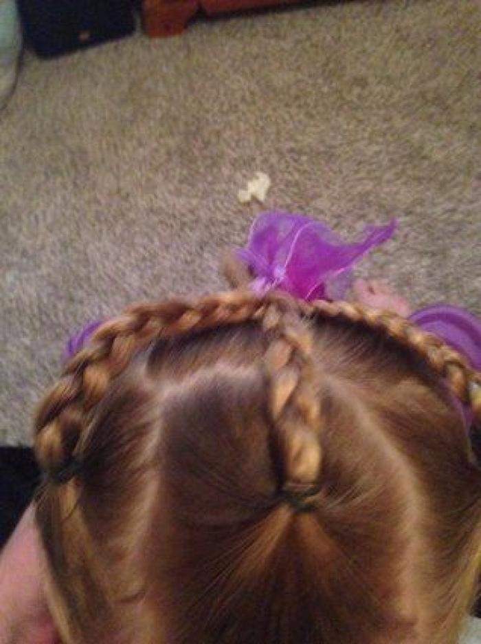 ¿Qué es lo que pasa cuando 'nos duele el pelo'?