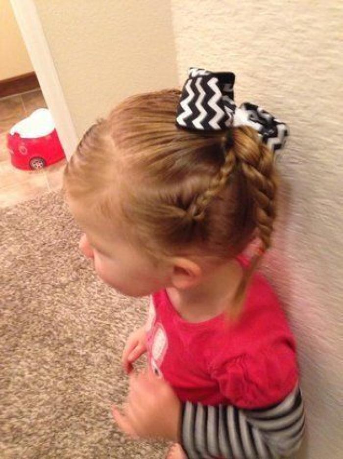 ¿Qué es lo que pasa cuando 'nos duele el pelo'?