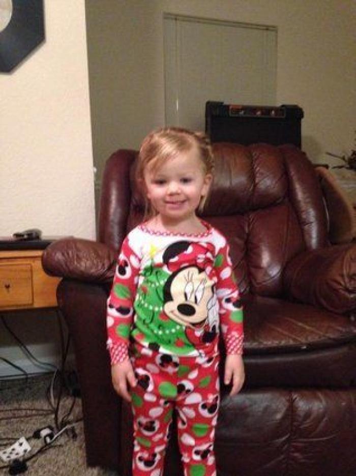 ¿Qué es lo que pasa cuando 'nos duele el pelo'?