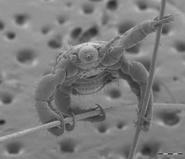 Al microscopio: insectos y otras 'maravillas' (FOTOS)